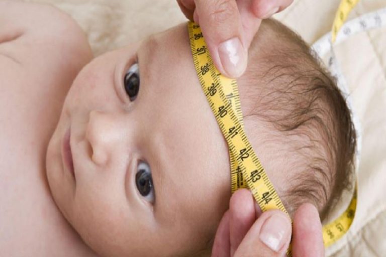 Bebeklerde baş çevresi ölçümü nasıl yapılır?