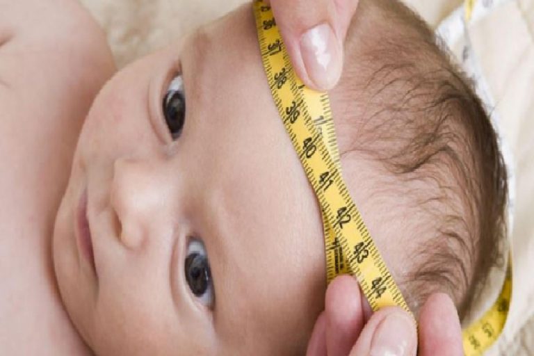 Bebeklerde baş çevresi ölçümü nasıl yapılır? Bebeklerde baş çevresi kaç cm olmalı?