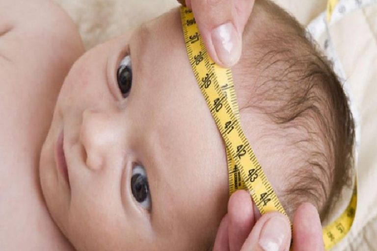 Bebeklerde baş çevresi ölçümü nasıl yapılır? Bebeklerde kafa sivriliği nasıl düzeltilir?