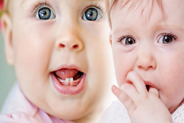 Bebeklerde diş çıkarmaya ne iyi gelir? İlk diş ne zaman çıkar, belirtileri neler? Ateşlenme…