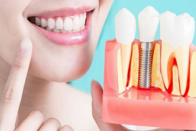 Hamilelere implant yapılır mı? Hamilelikte ağız ve diş sağlığında nelere dikkat edilmeli?