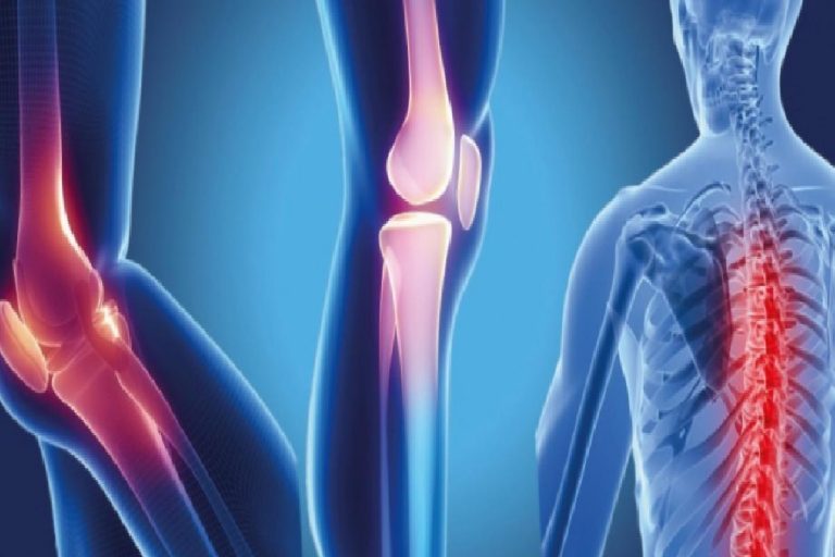 Osteopeni (Düşük kemik yoğunluğu) nedir ve belirtileri nelerdir? Osteopeninin tedavisi var mıdır?