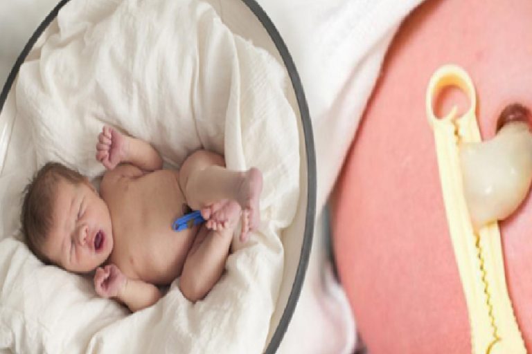 Plasenta Previa nedir? Bebeklerde göbek bağı bakımı nasıl yapılır? Göbek kordonu uzunsa…
