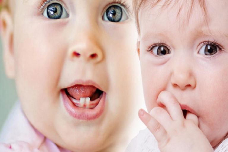 Bebeklerde diş çıkarmaya ne iyi gelir? İlk diş ne zaman çıkar, belirtileri! Ateşlenme…