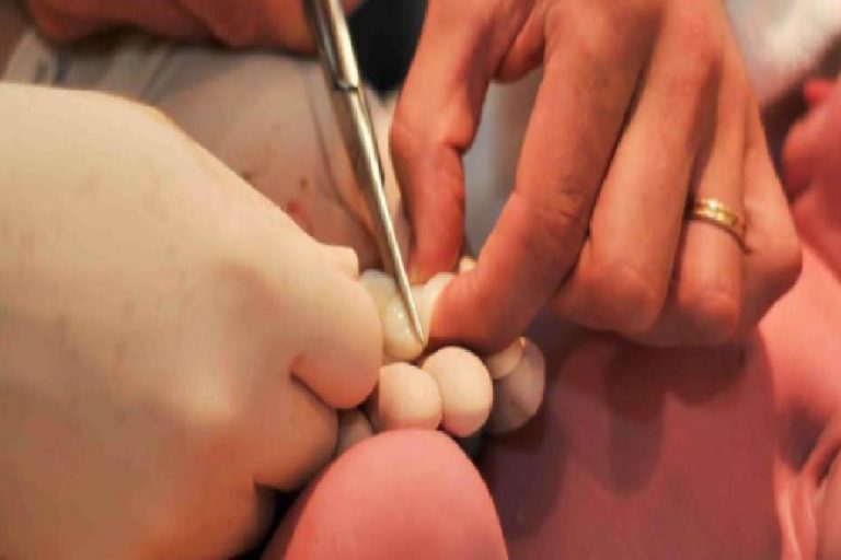 Bebeklerde göbek kordonu ne zaman kesilir? Göbek bağını geç kesmenin faydaları