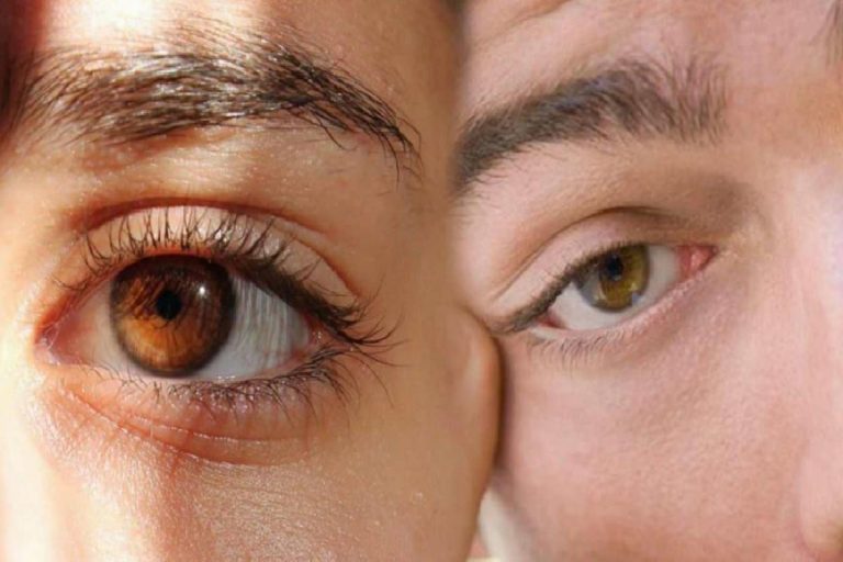 Göz seyirmesi ne anlama gelir? Sağ ve sol göz seğirmesi neden olur? Göz seğirmesi nasıl geçer?