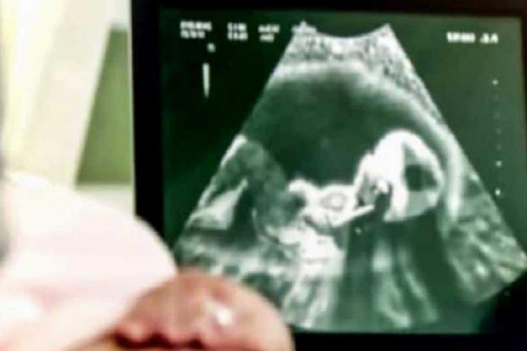 Hamilelikte detaylı ultrason kontrolünün önemi