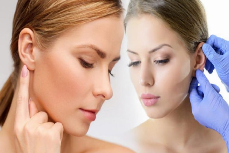 Kepçe kulak nedir ve neden olur? Kepçe kulak ameliyatı (Otoplasti) nasıl yapılır?