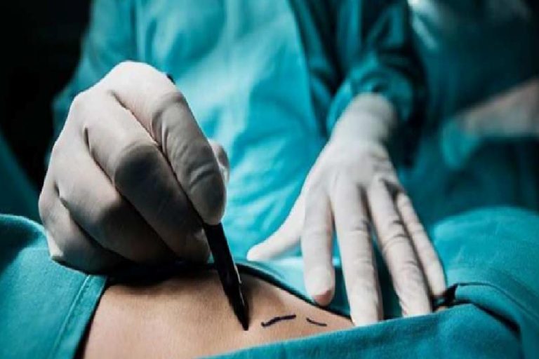 Liposuction Operasyonu nedir ve ne işe yarar? Lipoşakşın nasıl yapılır?