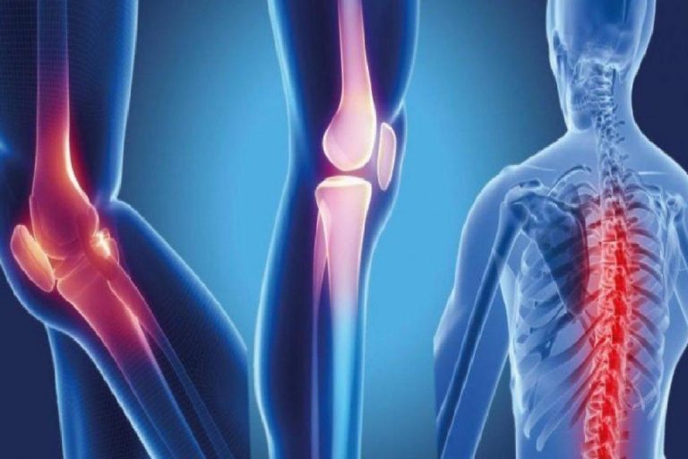 Osteopeni (Düşük kemik yoğunluğu) nedir? Düşük kemik yoğunluğu belirtileri nelerdir?