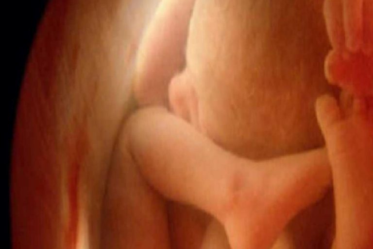 Ultrasonda bebeğin cinsiyetini göstermemesi! Kız ve erkek bebek ultrasonda nasıl görünür?