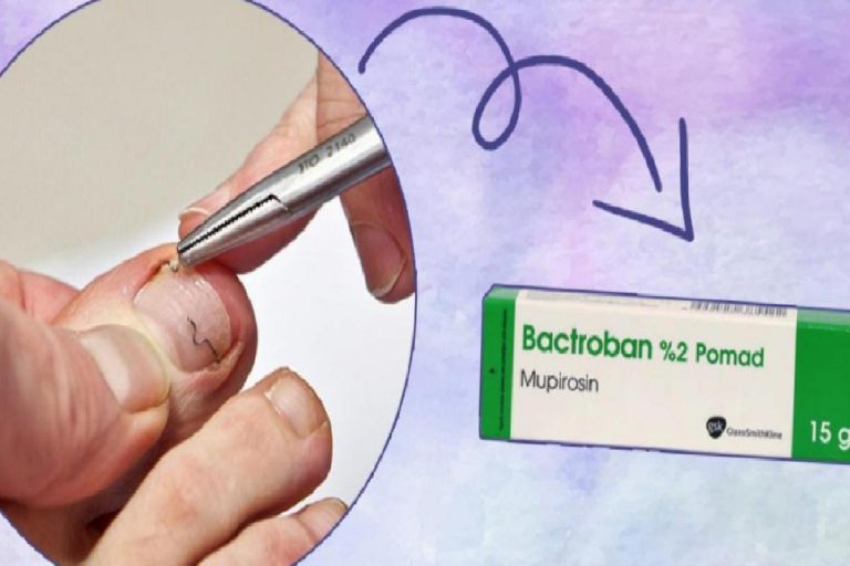 Bactroban krem ne işe yarar ve nasıl kullanılır? Bactroban pomad fiyatı 2022