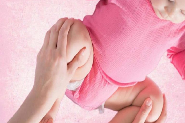 Kalça çıkığının (Displapizi) nedenleri nelerdir? Bebeklerde kalça çıkığı nasıl tedavi edilir?